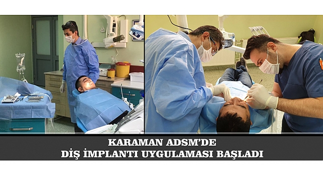 Karamanda Diş İmplantı uygulaması başladı