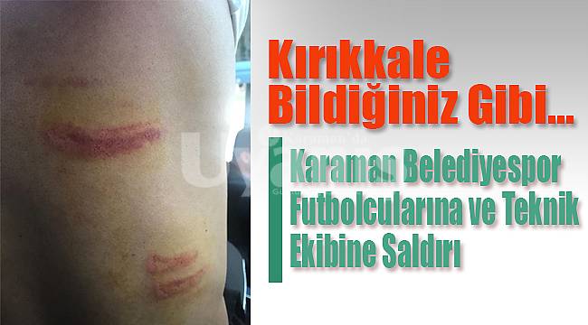 Kırıkkale'de Karamanlı futbolculara saldırı