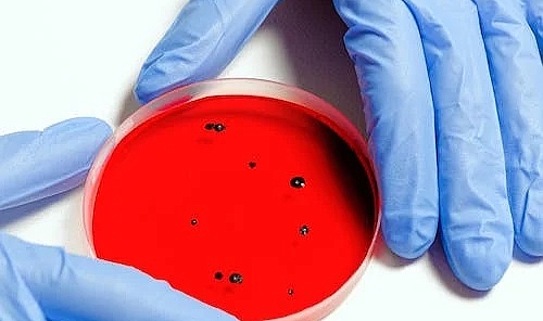 Mikroplastiklerin içerdiği zararlı maddeler kanser nedeni olabilir