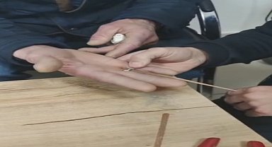 Parmağına sıkışan yüzüğü itfaiye çıkardı