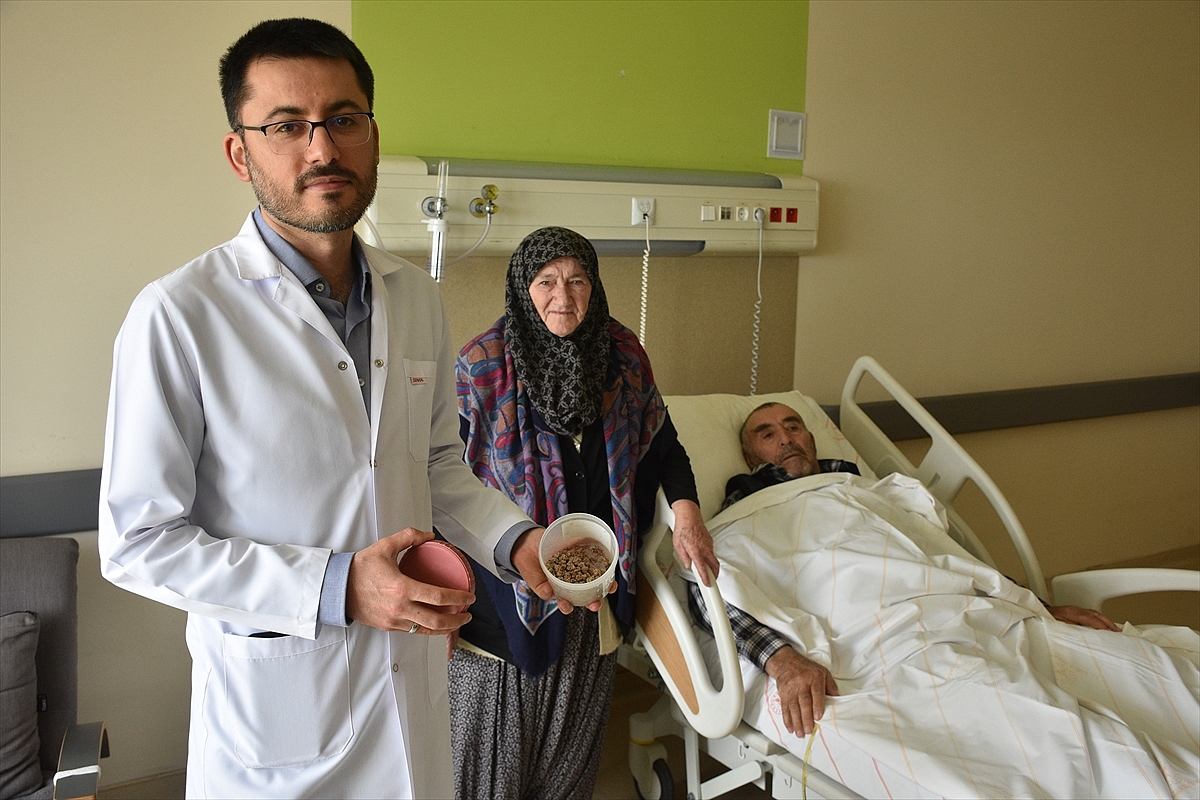 83 yaşındaki hastanın mesanesinden 250'den fazla taş çıkarıldı