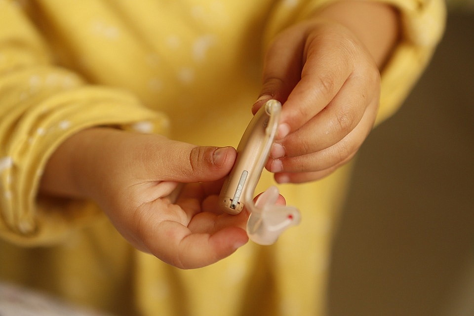 Koklear implant bebek ve çocuklardaki işitme kaybına çözüm oluyor