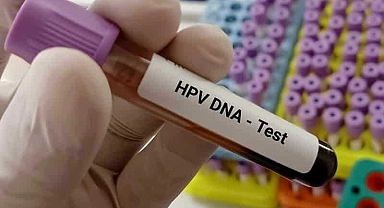 Uzmanından kadınlara 30 yaşından sonra HPV taraması önerisi