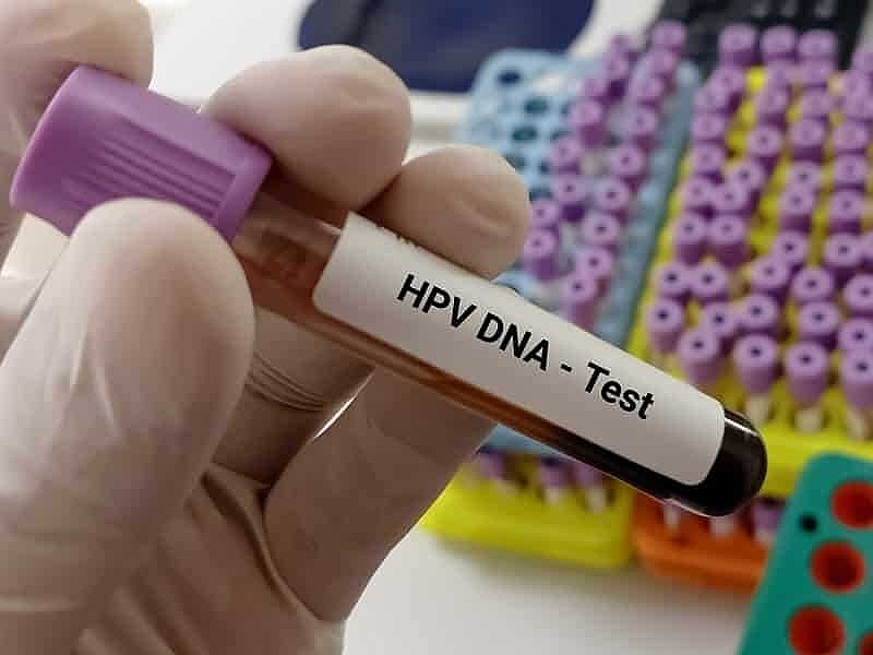 Uzmanından kadınlara 30 yaşından sonra HPV taraması önerisi