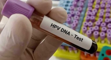 Uzmanından kadınlara 30 yaşından sonra HPV taraması önerisi
