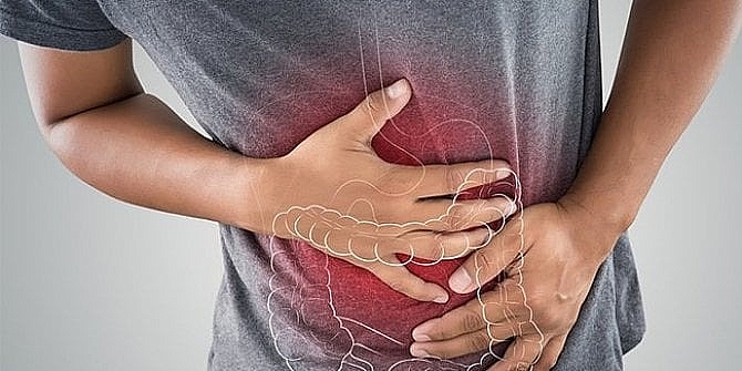 Yazın artan ishal vakalarında antibiyotik kullanılmaması uyarısı