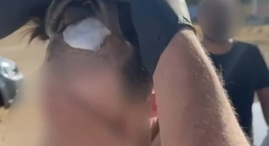 Şüphelinin protez saçından uyuşturucu çıktı