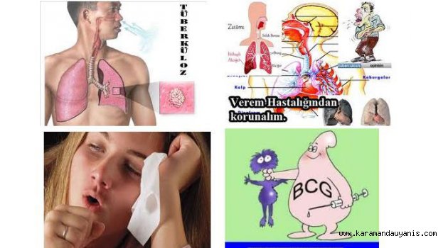 HEDEFİMİZ VEREMSİZ BİR TÜRKİYE