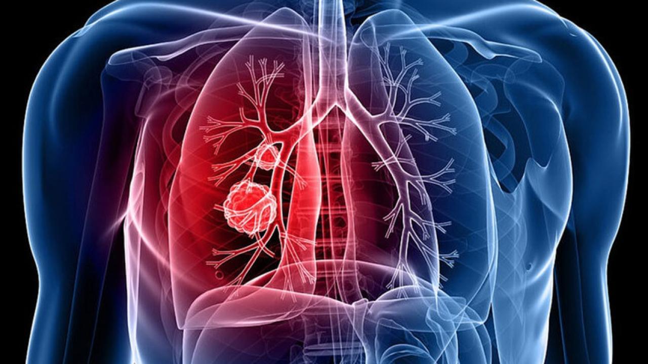 Karaman’da Verem Eğitimi ve Farkındalık Haftası